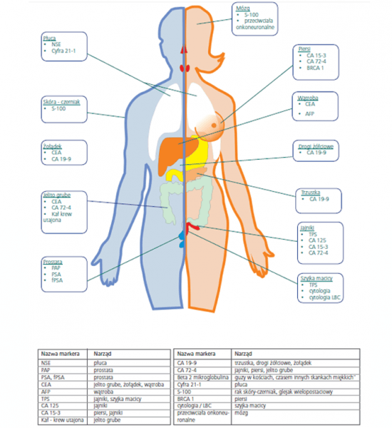 diagram dotyczący diagnostyki nowotworowej